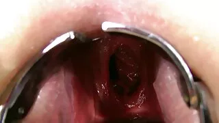Shameless descasca com pornos coroas o cara que atirou nela com esperma.
